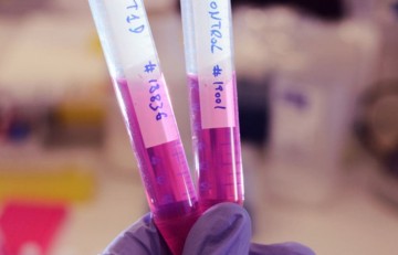 La insulina faster aspart en niños y adolescentes con diabetes tipo 1