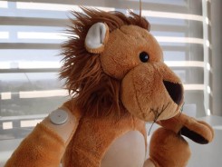 Mesurador continu de glucosa (CGM / FGM): què és i quins beneficis té