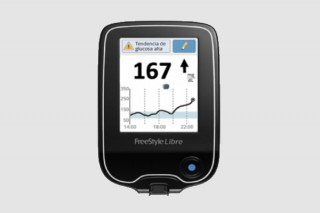 Com has d'interpretar les fletxes del teu sensor de glucosa